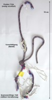 Hirschgrundturm, Vorderer - Hochzeitsgeschenk